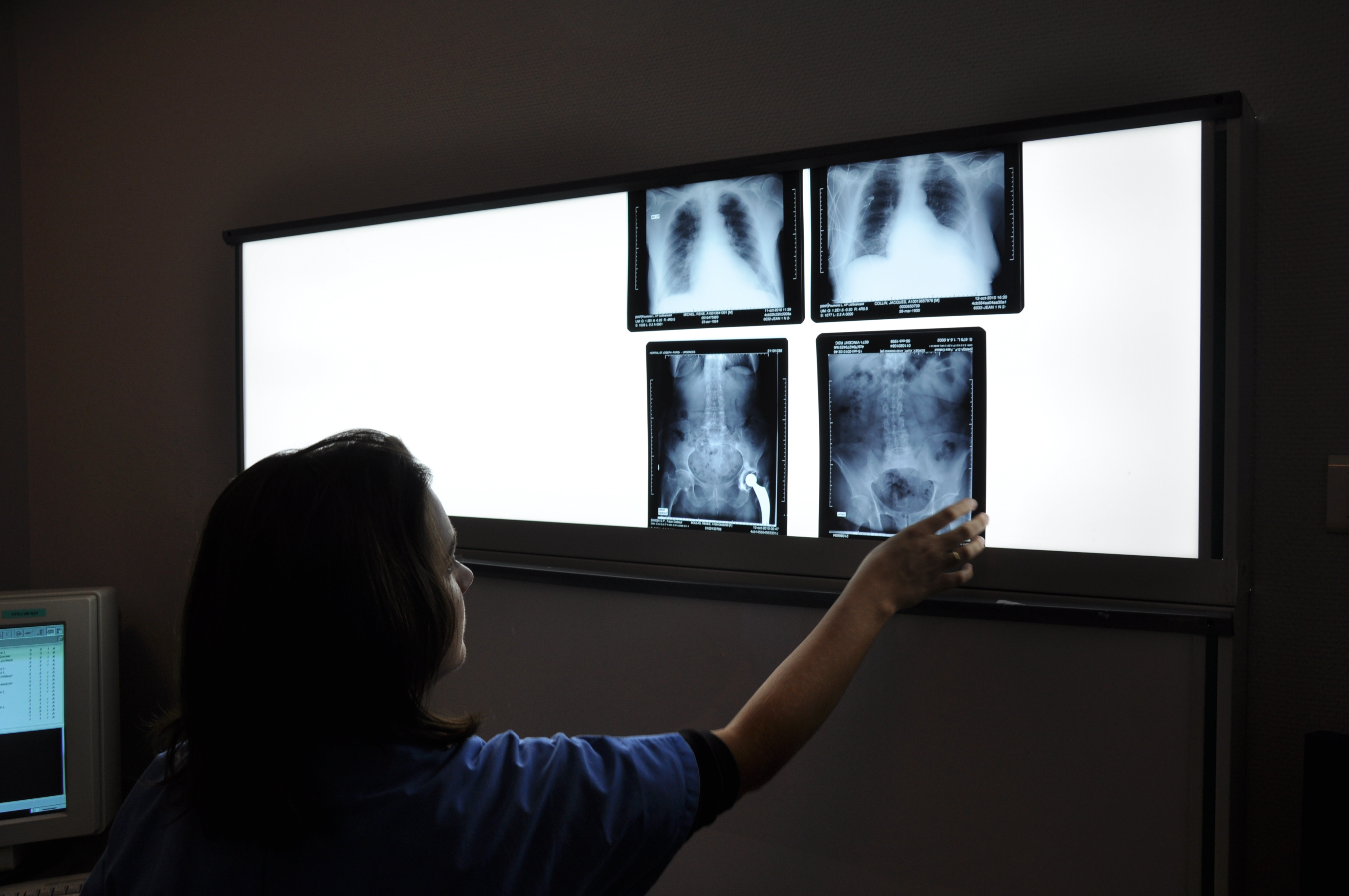 Doctors looking at X-ray scans